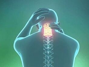 Симптом на цервикална остеохондроза е главоболка