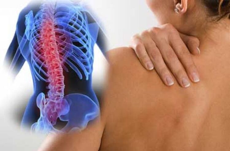 Со остеохондроза, болката може да зрачи до далечните делови од телото