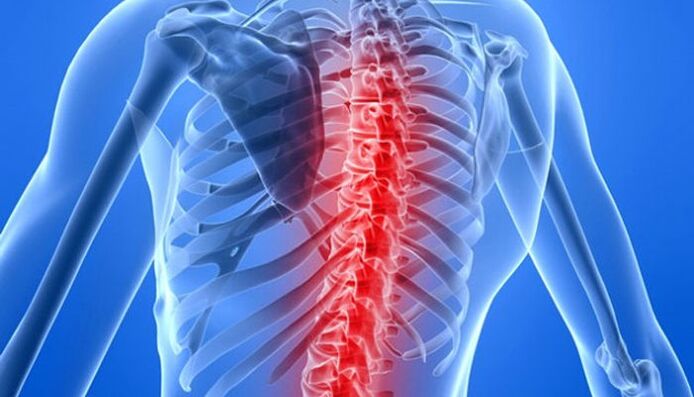 Патологиите на 'рбетот се најчестите причини за болки во грбот во пределот на рамото