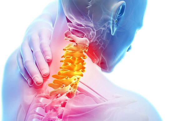 Цервикална остеохондроза